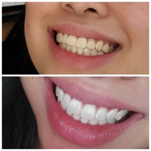 V34 The Corrector Toothpaste photo review