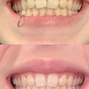 V34 The Corrector Toothpaste photo review